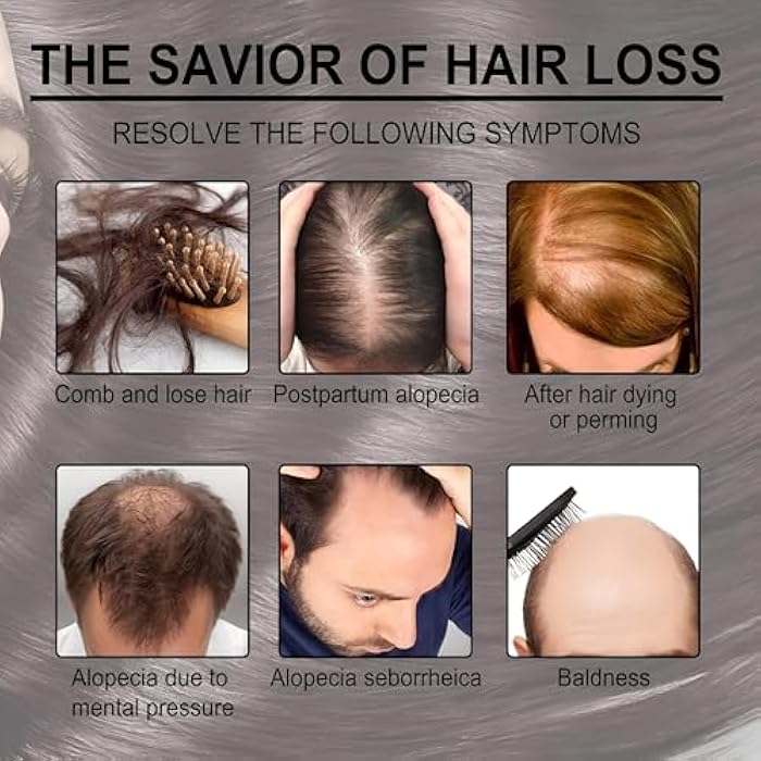 Nourishing Rosemary Oil - Say Goodbye to Hair Loss as this nutrient-rich oil stimulates growth, controls excess sebum and improves shine while preventing dryness and breakage. - Image 5